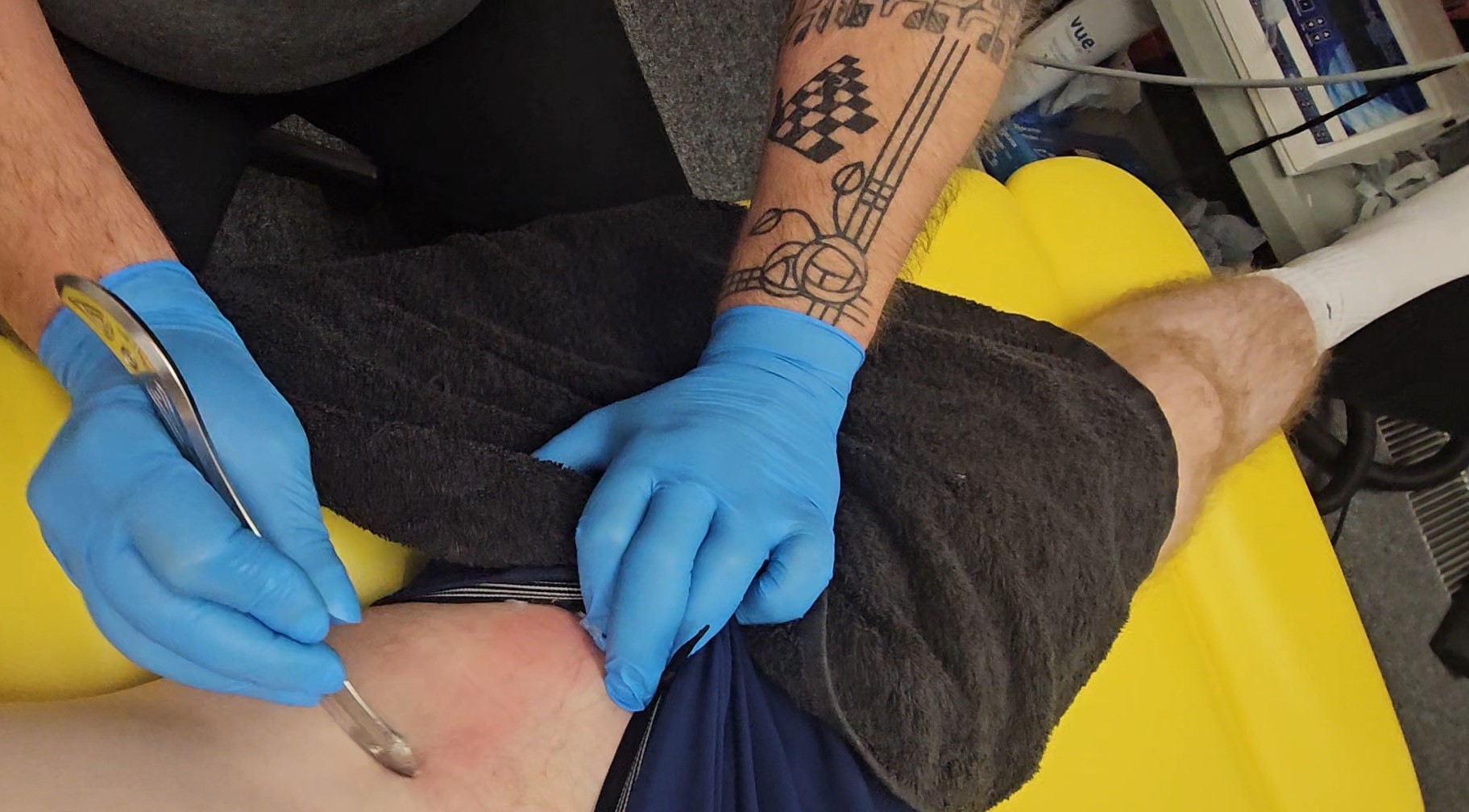 IASTM instrument-assisted soft tissue treatment at Glasgow Sport & Spine Clinic